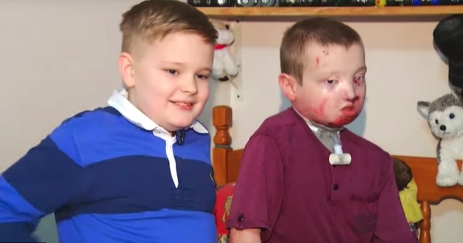 3rd-Grader Finds Purpose Helping Best Friend with Rare Skin Condition, Epidermolysis Bullosa