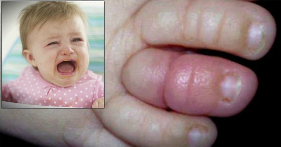 Dad Shares The Danger That Strangled His Baby's Toe