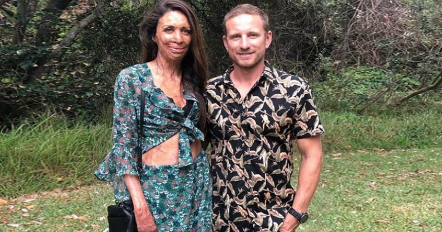 People Asked Turia Pitt's Husband If He Ever Thought Of Leaving After Her Accident