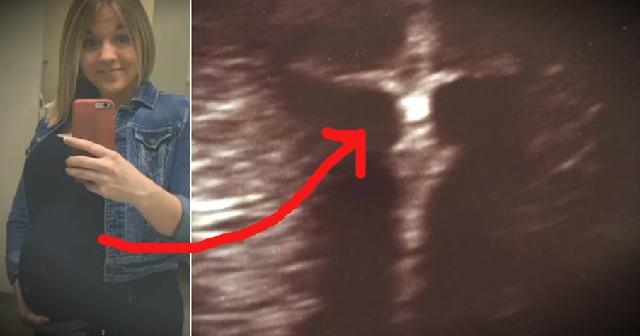 Mom's Ultrasound Photo Has A Powerful Message From Jesus