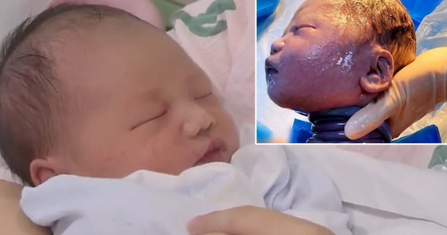 Doctors Amazed at Baby Born Unharmed with Umbilical Cord Wrapped Around His Neck 6 Times