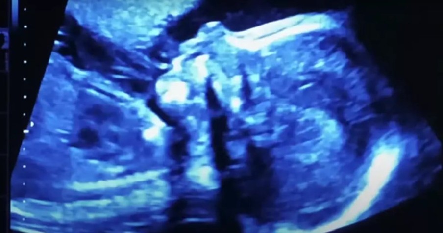 Some Major Networks Rejecting Ad Protecting Unborn Babies After Labeling It 'Too Controversial'