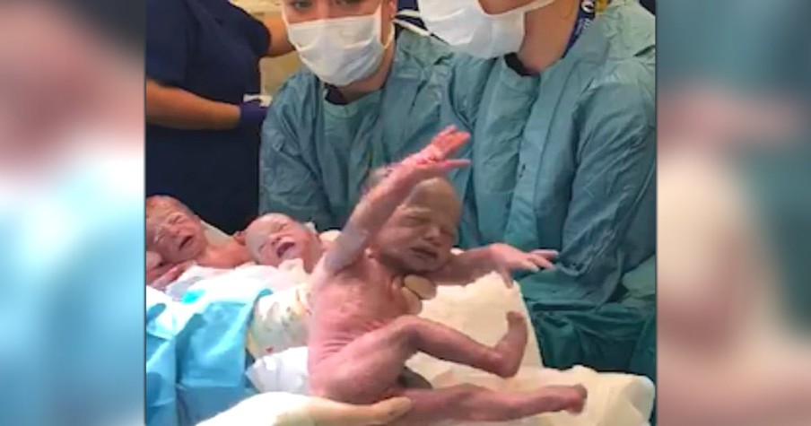 Video Of Triplets Arriving Via C-Section Shared By Mom In Honor Of 1st Birthday