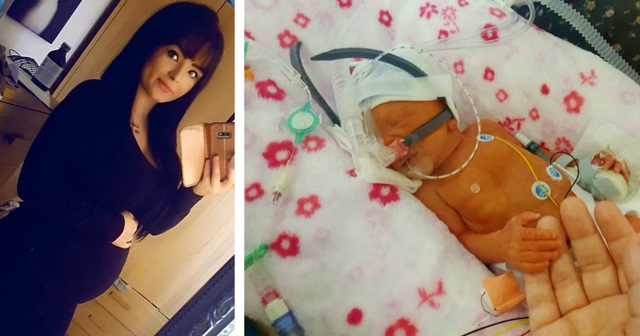 Mom's Water Broke Early At 13-Weeks But She Refused To End The Pregnancy