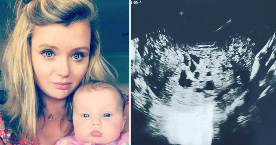 'Pregnant' Woman Is Heartbroken To Learn Her 'Baby' Is Actually A Tumor