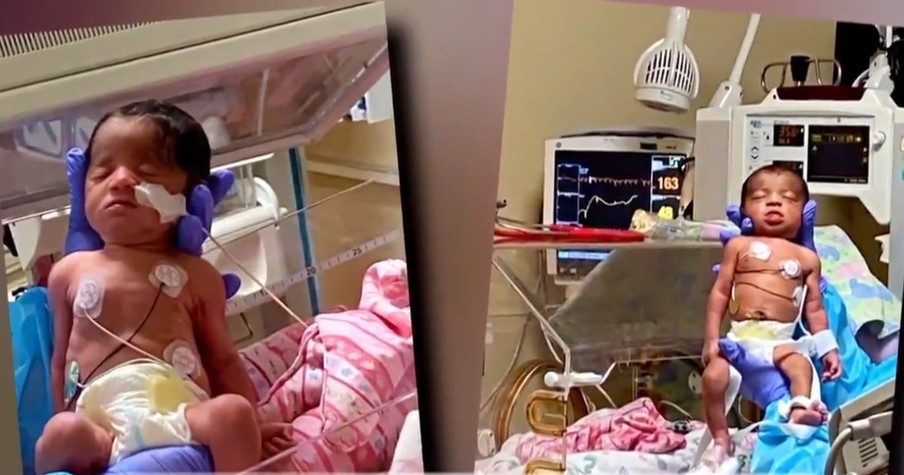 Mom Expecting Twins Wakes Up From Coma And Instantly Realizes She's No Longer Pregnant