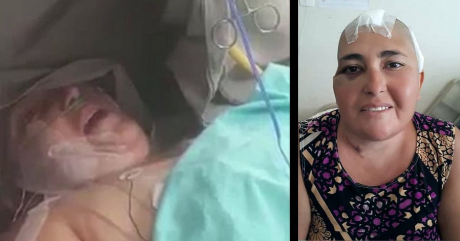 Woman Kept Awake During Brain Surgery Sings Thanks To God