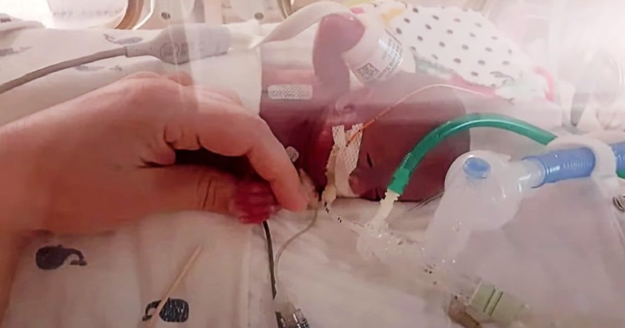 World's Most Premature Baby Given 0% Chance Of Survival Proves Why You Never Say Never