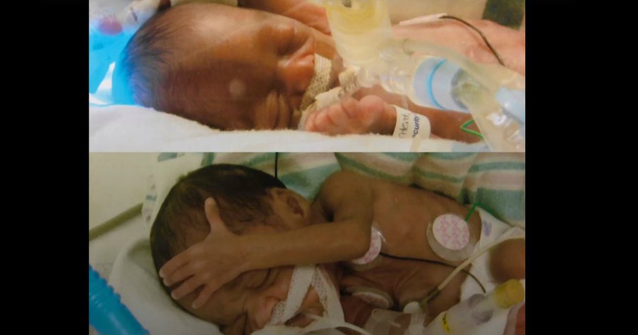 NICU Nurse Found The Reason For Her Twins Being Born Prematurely