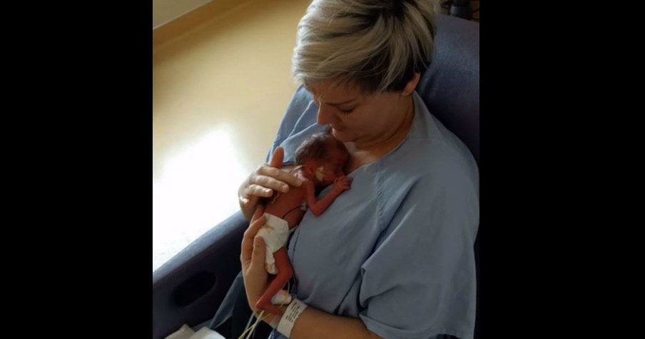 She Had Her Baby Ten Weeks Early And She Finally Held Him