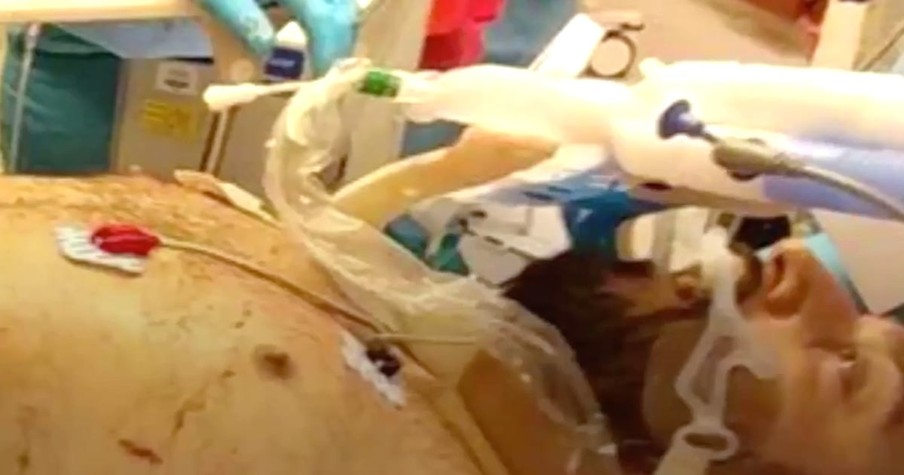 Man Hit by Train Was Nearly Cut In Half But Now He's A Walking Miracle