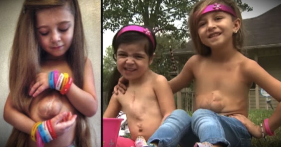 Jesus Gave This Little Girl A Special Heart, And Now A Special Friend Too