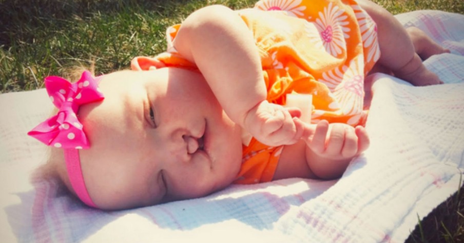 The Way This Mom Responds To Stares At Her Baby’s Cleft Palate Is So Powerful!
