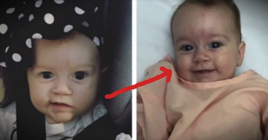 Their Baby’s Brain Tumor Baffled Doctors After God Sent A Miracle