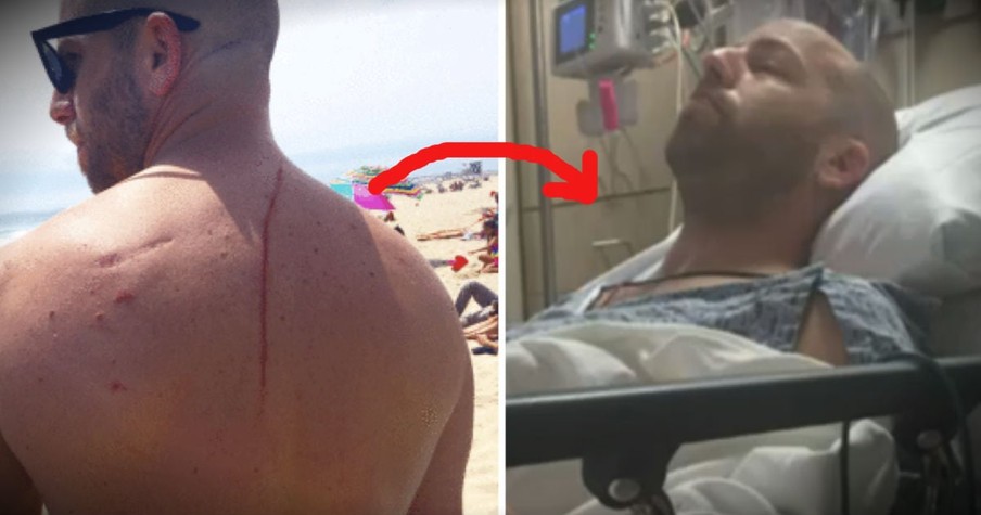 Shark Attack Turns Out To Be A Blessing When Doctors Find Tumor