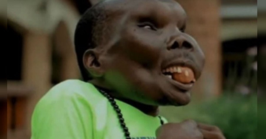 The ‘Ugliest Man Alive’ Is Proving To Haters That Beauty Is Only Skin Deep!
