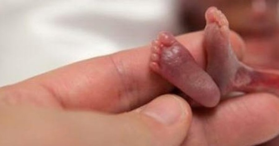 A Loving Family Discovers the Miracle of Life Through This Premature Baby Boy