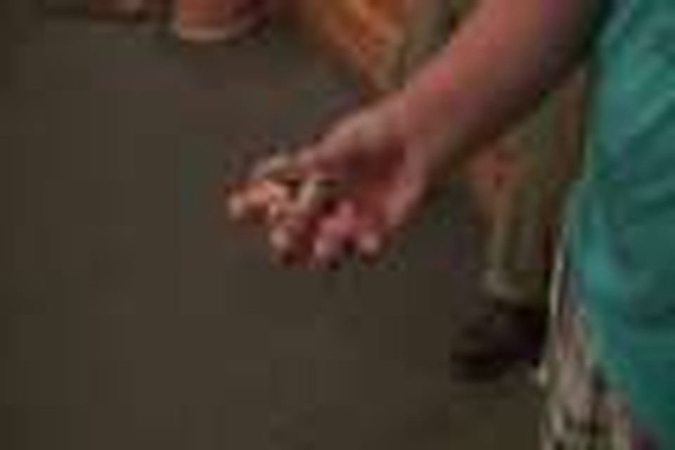 Broken thumb healed