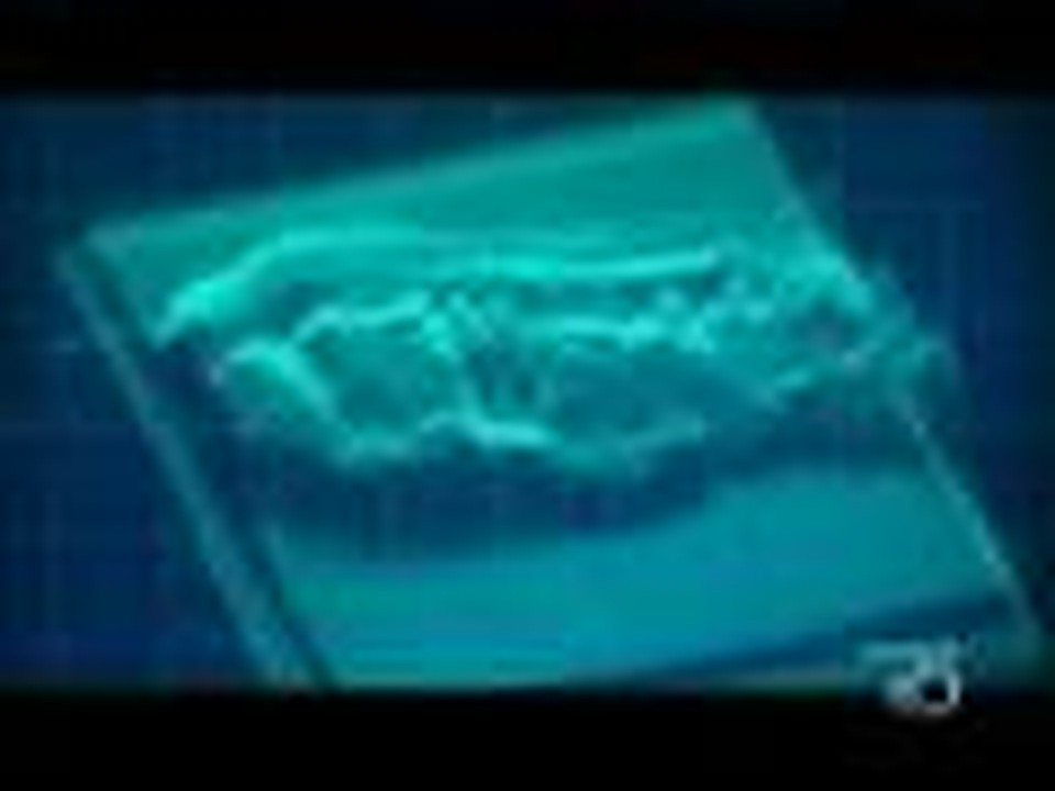 Shroud - New Evidence Overturns Carbon dating - Part 1 of 2