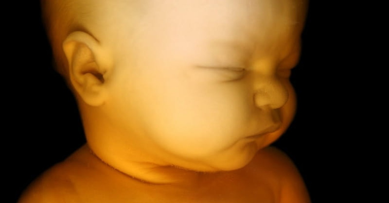 10. Planned Parenthood supports infanticide through advocacy of partial-birth abortion