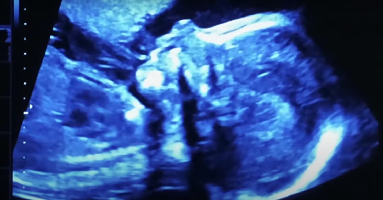 A sonogram of a baby in the womb, TV networks reject a pro-life ad