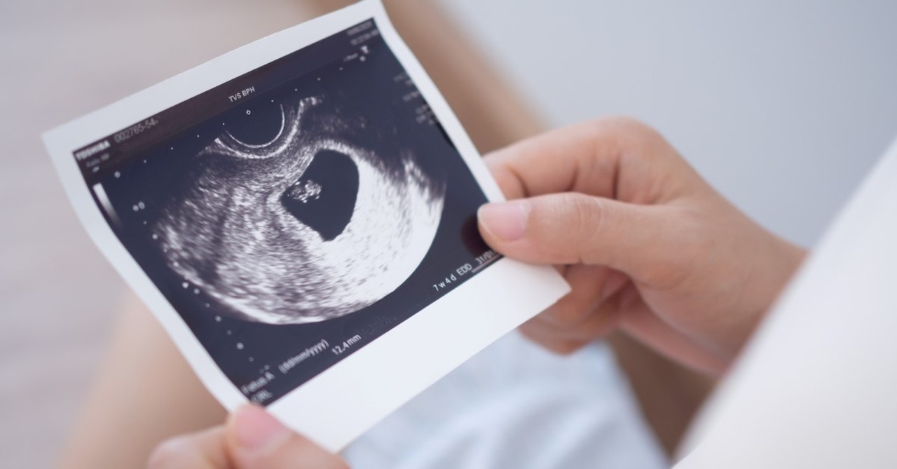 woman holding ultrasound