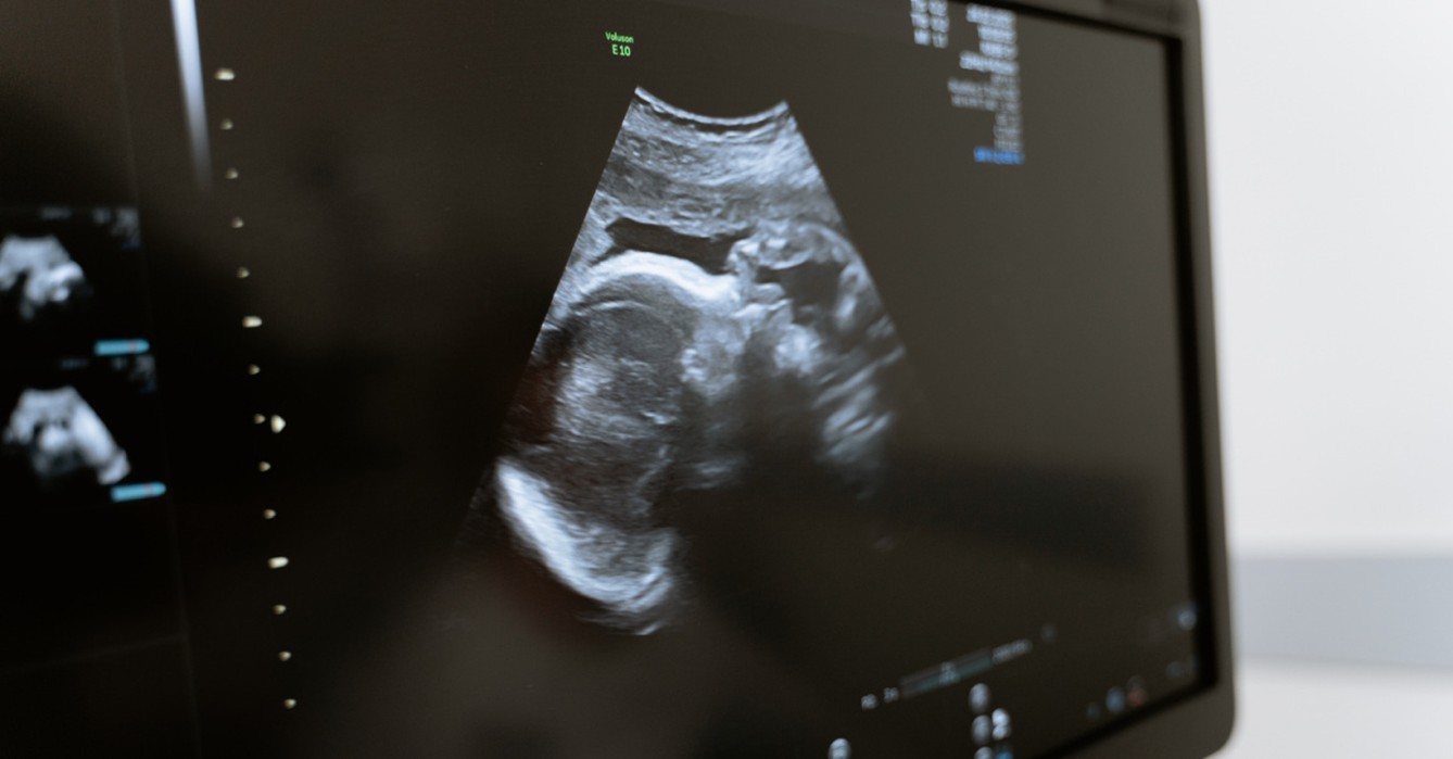 An ultrasound of a baby, pro-life group calls for investigation into DC abortion clinic
