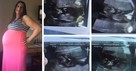 4th of July Quadruplets Blesses Desperate Couple after 4 Miscarriages and 11 Years of Infertility