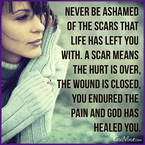 Never Be Ashamed of the Scars Life Has Left You