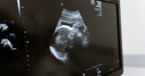 Answering Abortion Assertions: Embryos Aren't People