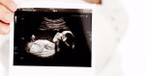 See Life: The Power of Images of the Preborn