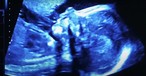 CBS, Hallmark Reject Pro-Life Ad that Shows Ultrasounds, Babies: 'Too Controversial'