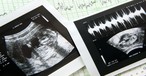 Colorado Passes Controversial Bill Declaring the Fetus 'Does Not Have Independent' Rights