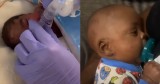 Miracle Baby Celebrates First Birthday After Being Born Under a Pound