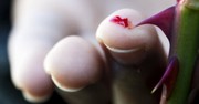 What I'm Learning from My Thorn in the Flesh