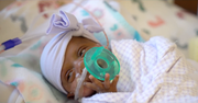 Record-Setting Baby, Born Weighing 8.6 Ounces, Goes Home Healthy