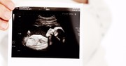 'Babies in the Womb': NBC's Today Surprises Pro-Lifers with 3D Ultrasound Story