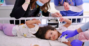 Twin Sisters Conjoined at the Head Successfully Separated in Life-Changing Surgery 