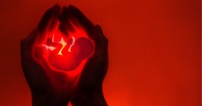 Scientists Agree Life Begins at Conception So What’s the Problem with Banning Abortion? 