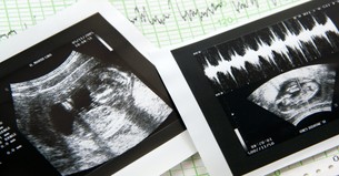 The Surrogacy Shop of Horrors