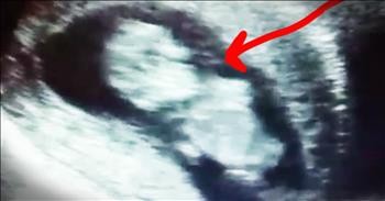 11-Week-Old Baby Dances In Mama's Womb