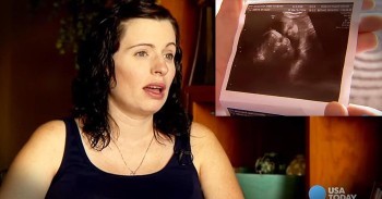 Mom Of Conjoined Twins Turns To Prayer To Cope