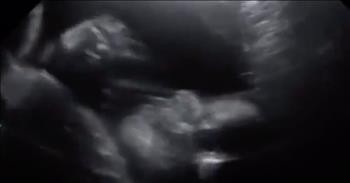 Unborn Baby Waves During Ultrasound