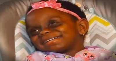Cyber Bullies Call Toddler With Rare Disease A Monster 