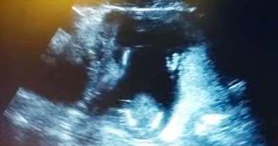 Baby Claps Along To Song During Ultrasound 