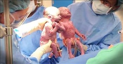 Rare Twins Born Holding Hands Celebrate Birthday 