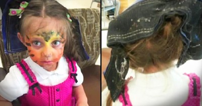 Parents Warn Of Bounce House Dangers After Daughter's Hair Gets Caught 