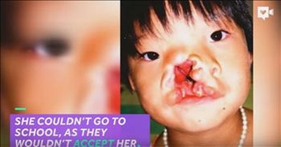 Young Girl's Massive Facial Deformity Fixed By Amazing Surgeons 
