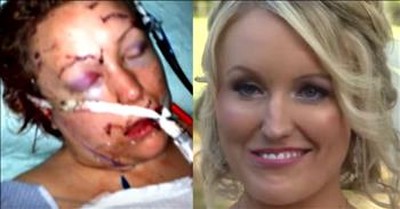 Woman Stabbed By Boyfriend, Marries EMT Who Saved Her And Gets Her Smile Back 