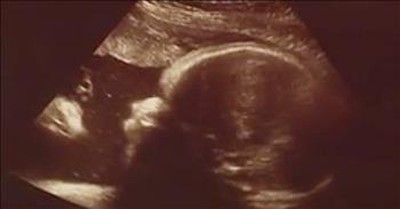Couple Sees Jesus In Ultrasound Picture 